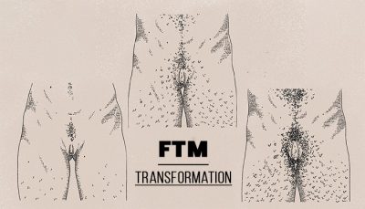 What is FTM bottom growth