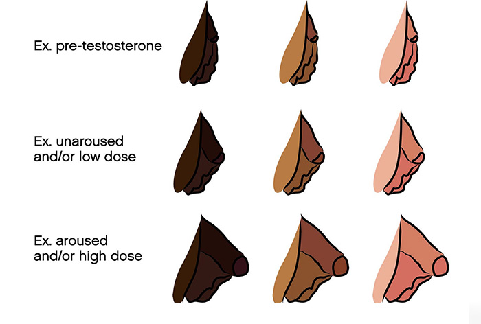 FTM Bottom Growth A Guide from Female To Male