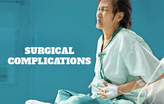  How to Avoid Surgical Complications