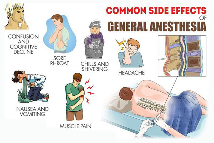 The Risks of General Anesthesia