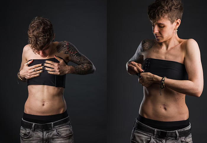 The Importance of Chest Binding for Transgender Individuals