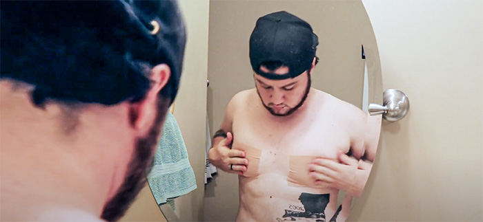 Transgender man shares images of his taped back breasts