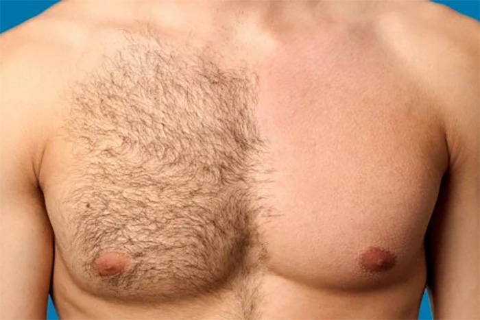 Pulling Out Chest Hair