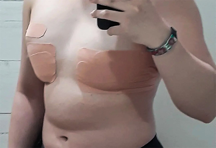 Here's What Parents Need To Know About Chest Binding, Trans Tape