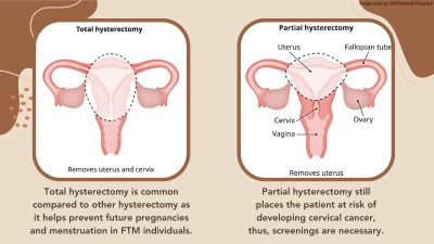 FTM Hysterectomy