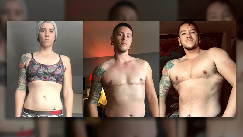 Everything You Need to Know About FTM Transformation in 2024