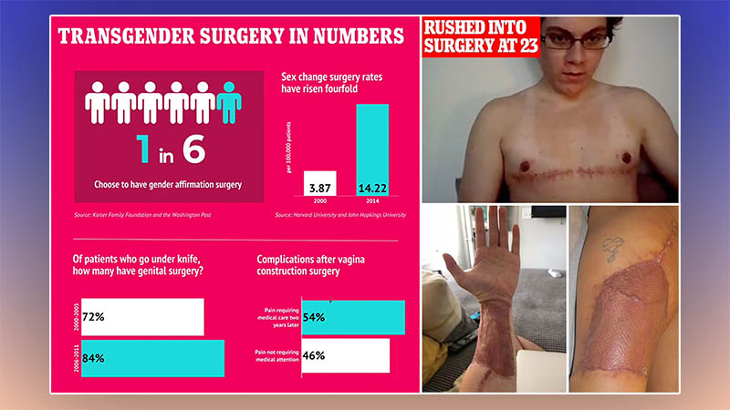 Everything You Need to Know About FTM Transformation in 2024