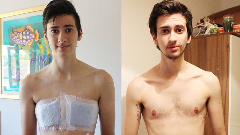 Everything You Need to Know About FTM Transformation in 2024