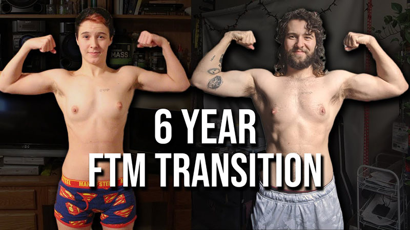 Everything You Need to Know About FTM Transformation in 2024