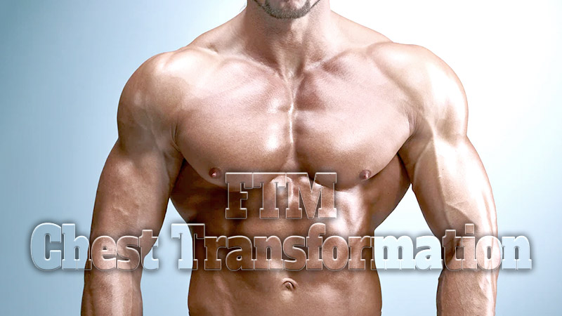 FTM Chest Transformation_ How to Achieve a Male-Looking Chest 