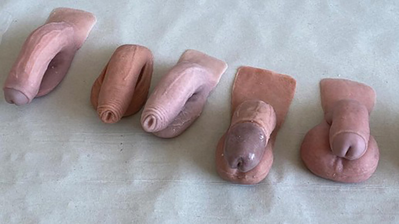 How Does a Trans Man Get a Penis