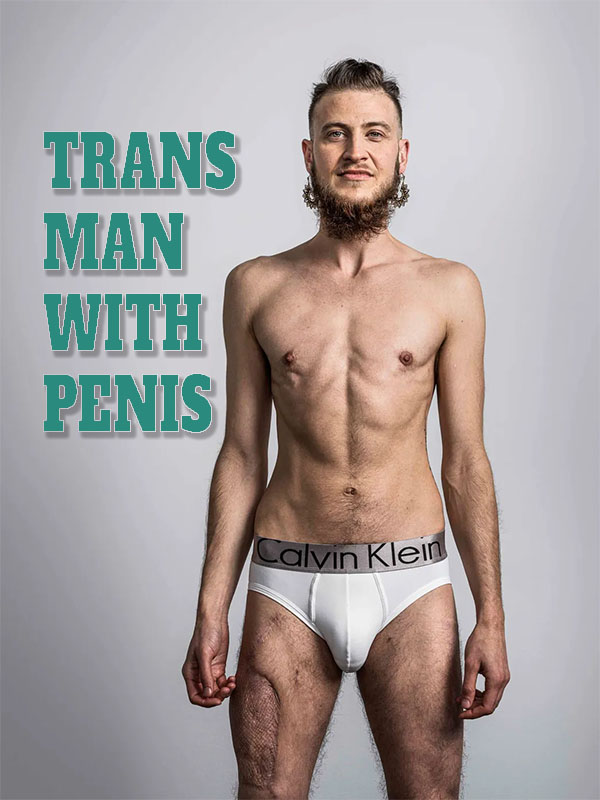 How Does a Trans Man Get a Penis