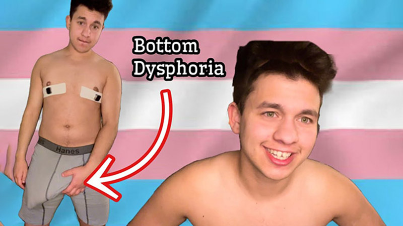 Ultimate Guide to FTM Bottom Growth and How to Manage Changes