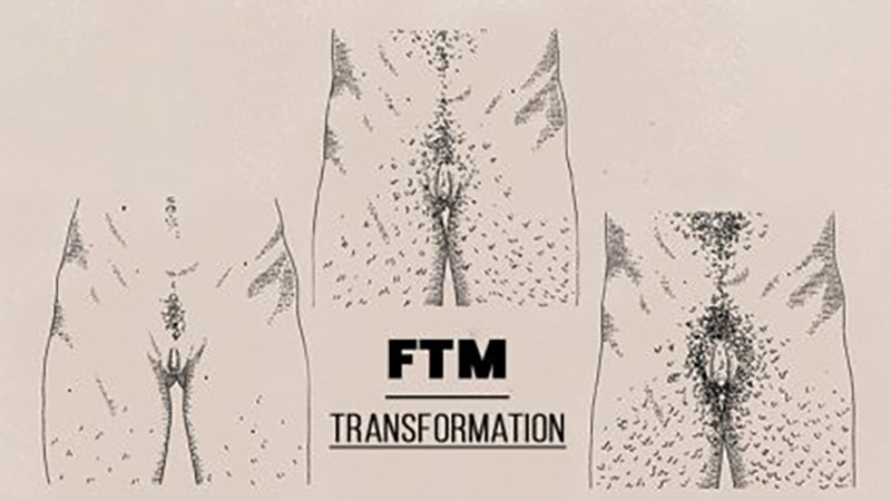 Ultimate Guide to FTM Bottom Growth and How to Manage Changes