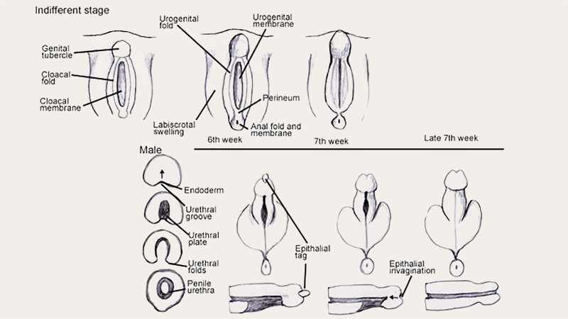Ultimate Guide to FTM Bottom Growth and How to Manage Changes