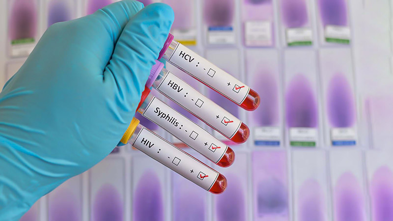 7 Essential Health Tips Every Trans Man Needs to Know