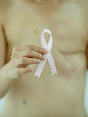 Are Transgender Men at Risk for Breast Cancer? Key Facts You Should Know