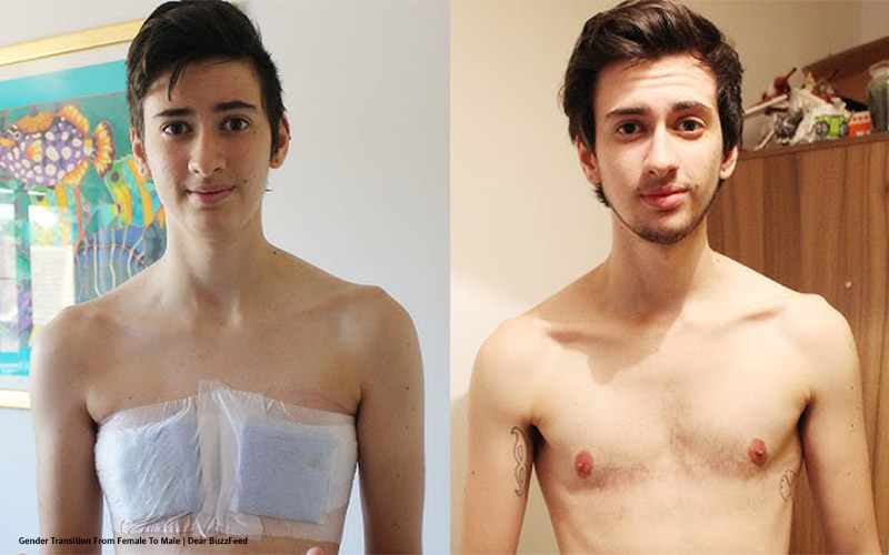 What is it Like to Be a Trans Man? Dysphoria, Transition and Social Acceptance