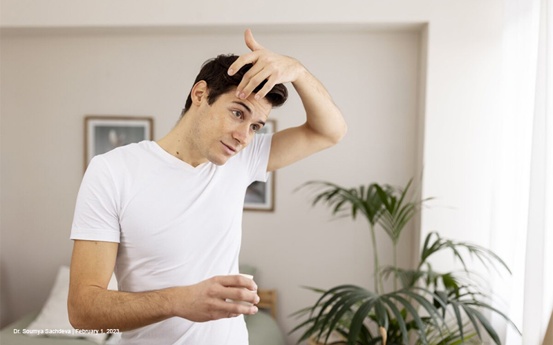 FTM Hair Loss: Understanding and Managing Balding on Testosterone