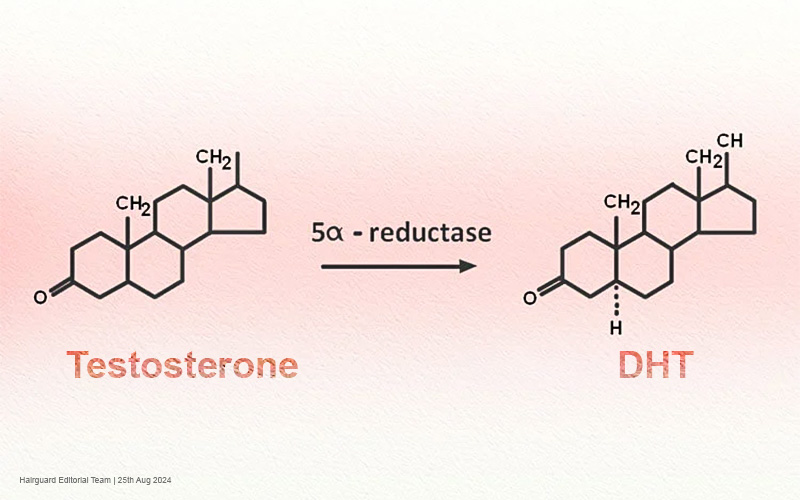 FTM Hair Loss: Understanding and Managing Balding on Testosterone