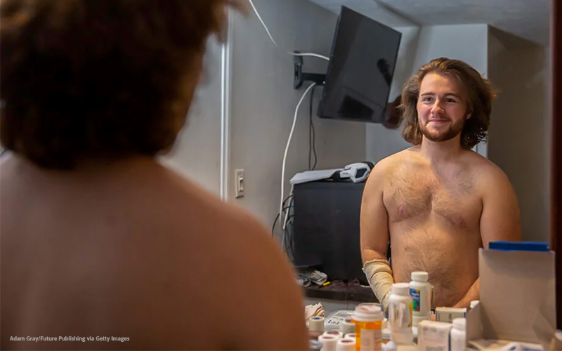 A Guide to FTM Sexual Health with a Focus on Post-Transition Care