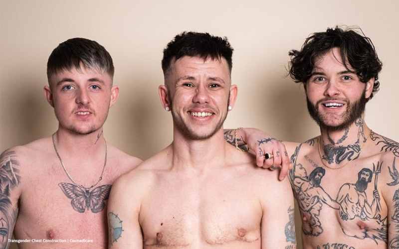 A Guide to FTM Sexual Health with a Focus on Post-Transition Care
