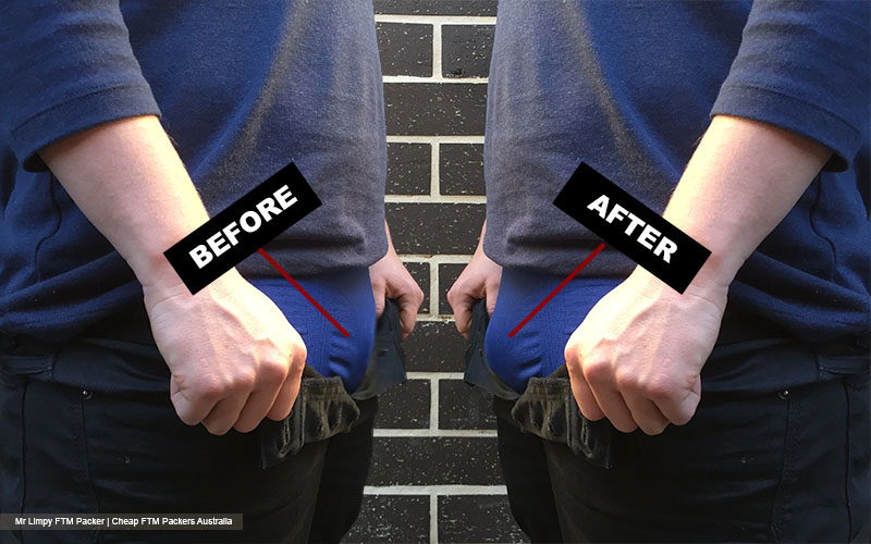 How to Wear a Packer: A Comprehensive Guide for FTM Individuals