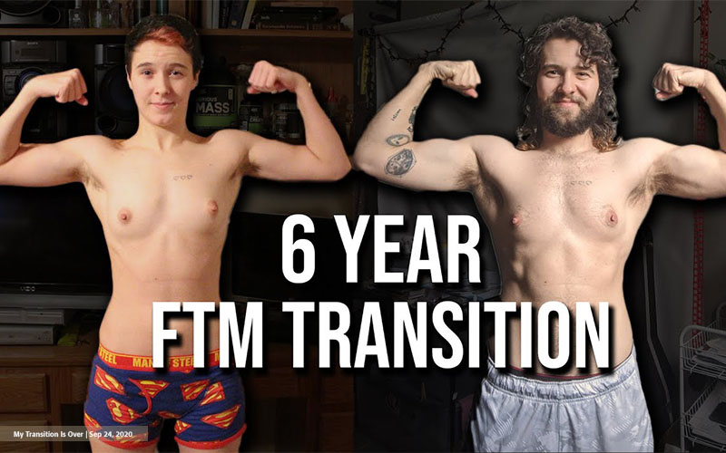 Is It Too Late to Transition? Embracing Your FTM Journey at Any Age