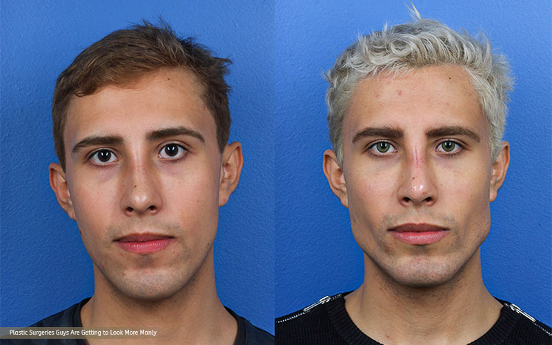 How to Achieve a More Defined Jawline