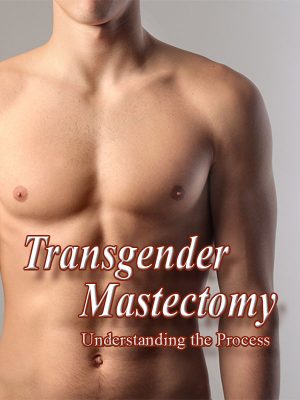 Transgender Mastectomy: Understanding the Process
