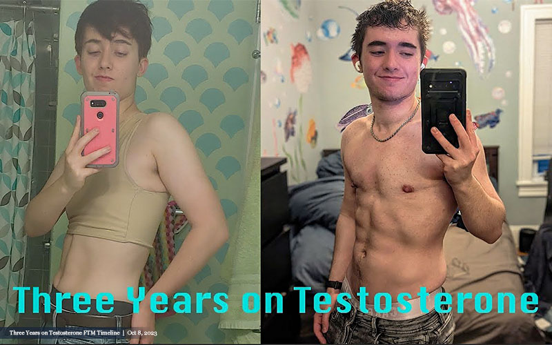 Weight, Health, and Transition: An FTM Guide